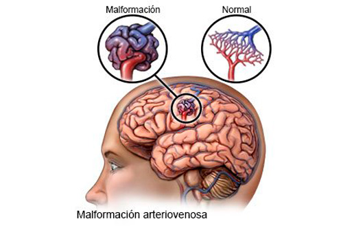 MALFORMACION